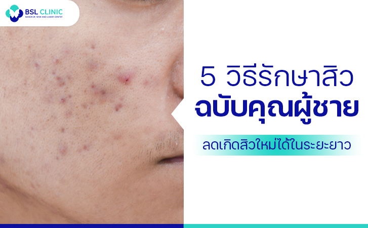 bslclinic-acne-treatments-feature-img-37.jpg